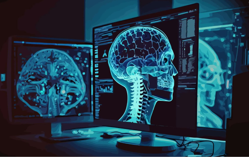AI in medical imaging